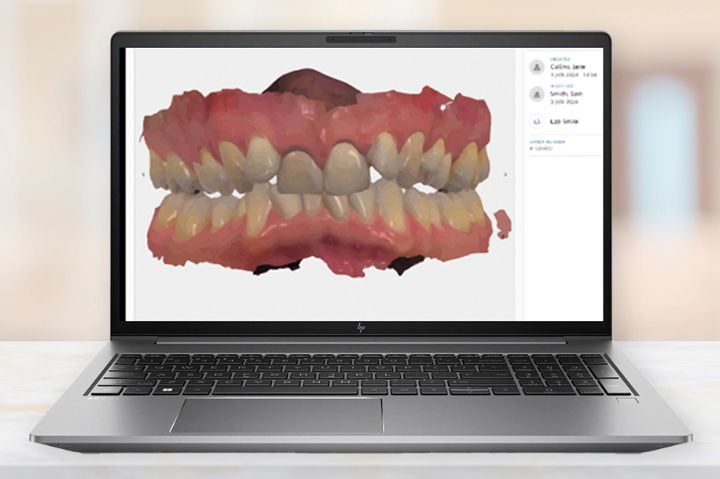 Nøjagtigt digtialt aftryk med TRIOS scanner