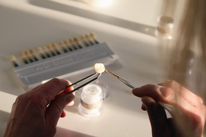 Tandkrone bliver klargjort hos PlanLab